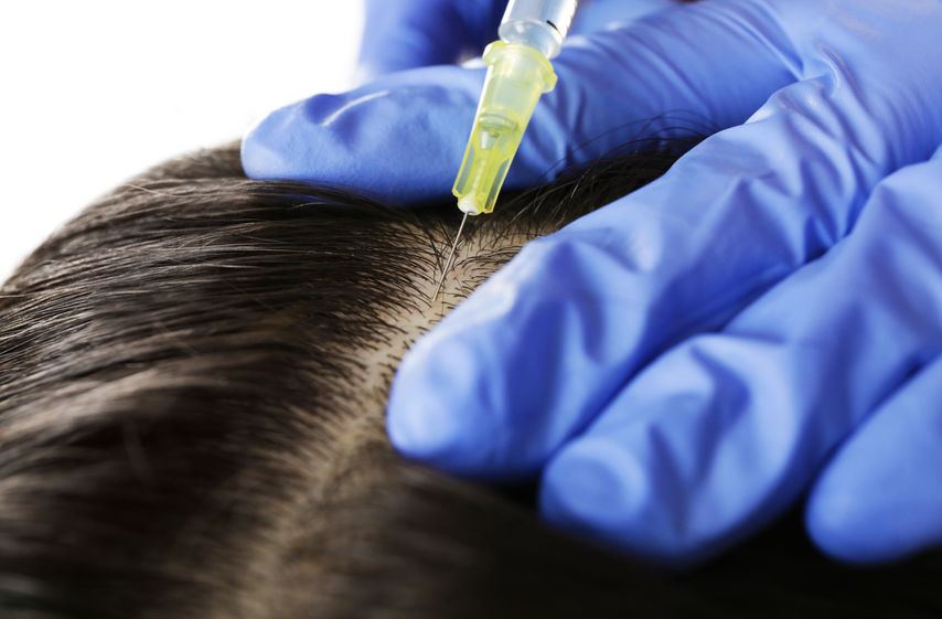 Wypadanie Włosów Jak Znaleźć Przyczynę Dietoterapia
